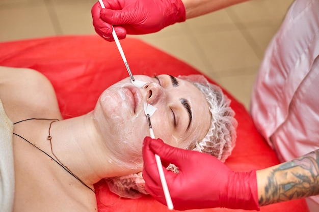 Peeling kwasowy do twarzy skuteczny i bezpieczny