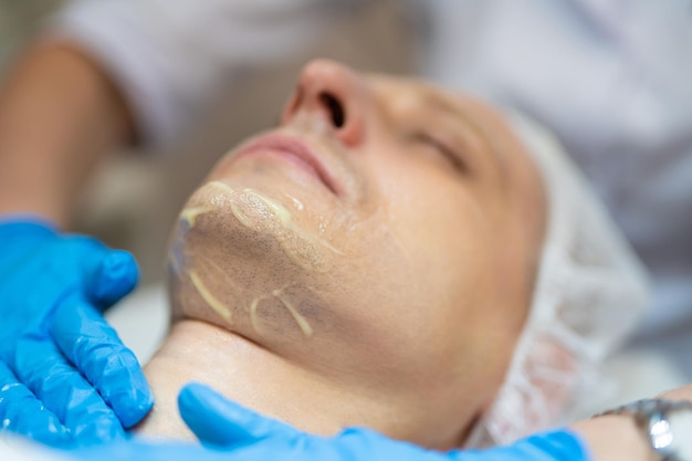 Peeling fenolowy korzyści i efekty zabiegu